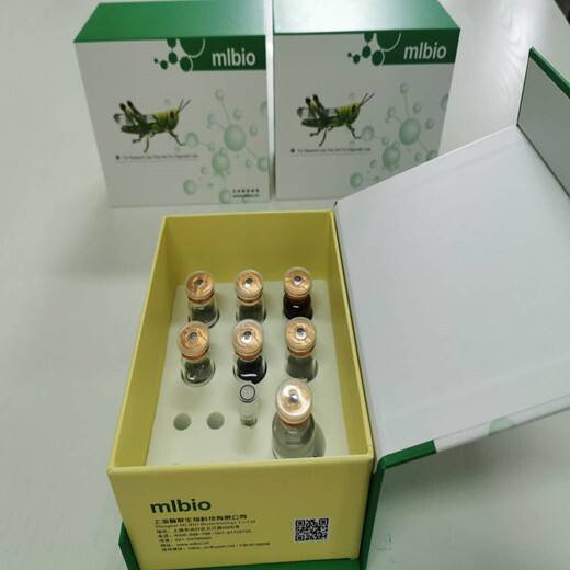 大鼠二肽基肽酶Ⅳ(DPP4)动物ELISA试剂盒代测免费