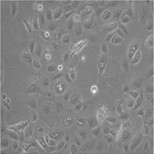 兔输尿管平滑肌细胞图片4