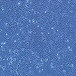兔输尿管平滑肌细胞图片3