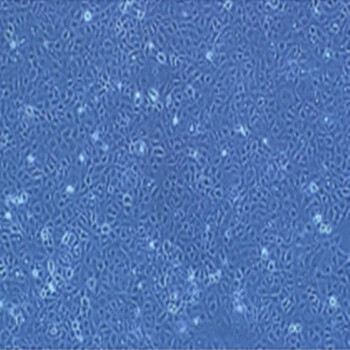 兔shi网膜微血管内皮细胞