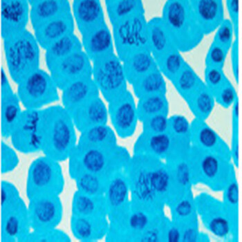 人胎盘间充质干细胞