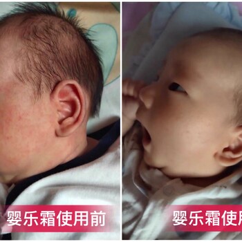 微商創(chuàng)業(yè)麻哈嬰樂霜全國招商