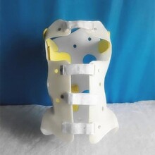 3D打印脊柱侧弯矫形器