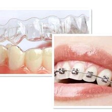 3D打印隐形牙套正畸制作个性化定制