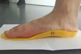 扁平足3D打印个性化定制矫形鞋垫