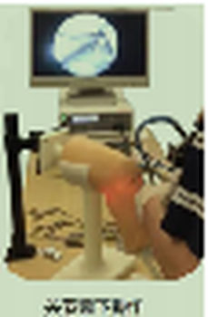 交互式膝关节镜手术模拟训练系统
