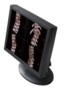 磁共振诊断6M防磁显示器GE磁共振显示器磁共振高清显示器