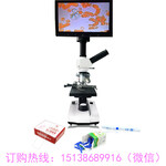 显微镜高清一滴血检测仪厂家郑州明举科技