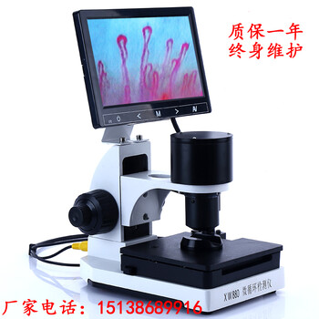 XW880高清微循环检测仪心脑血管分析仪厂家郑州明举科技