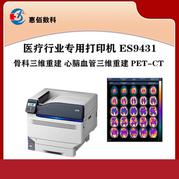 三维重建血管造影PET-CT医疗打印机ES9431