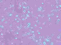 NCM460贴壁形式细胞株技术硬	