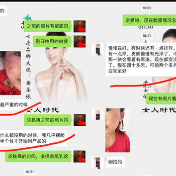 修复激素脸，就找七老小妖